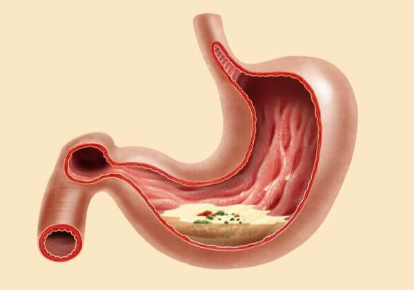 Low Stomach Acid