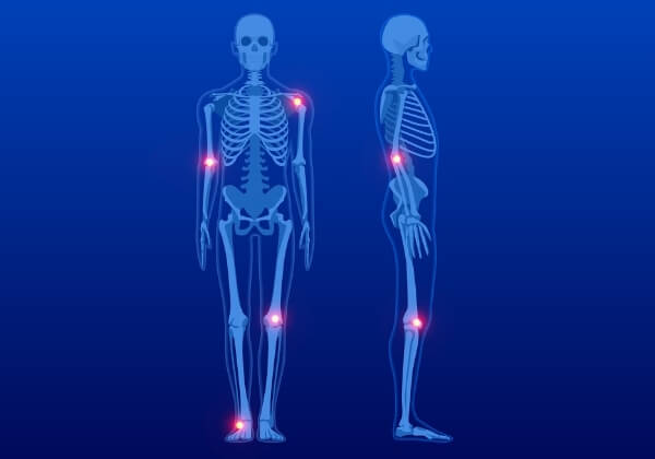 5 Common Bone Health Myths Debunked