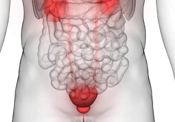 Cystitis Real Cystitis: Causes, Symptoms, and Variations – 1MD Nutrition