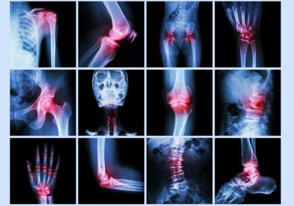 Joint Function Numbers Proper Doctor Evaluation of Joint Function & What the Results Mean ...