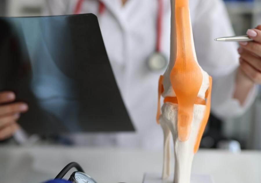 Top 8 Questions Rheumatologists Get Asked About Joint Health